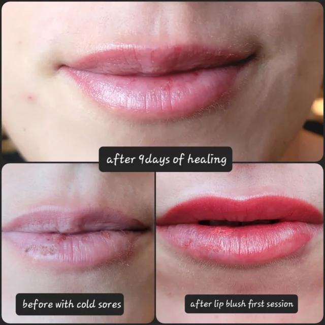 💋 Lip blush for this gorgeous 😍 

More pictures coming soon 📸🤳

#saudiarabia #Riyadh #pmu #lipblush #semipermanenttattoo #cosmetictattooing #coldsores #pinklips #healingjourney #thezone #permanentmakeup #artiststudio #pmulife